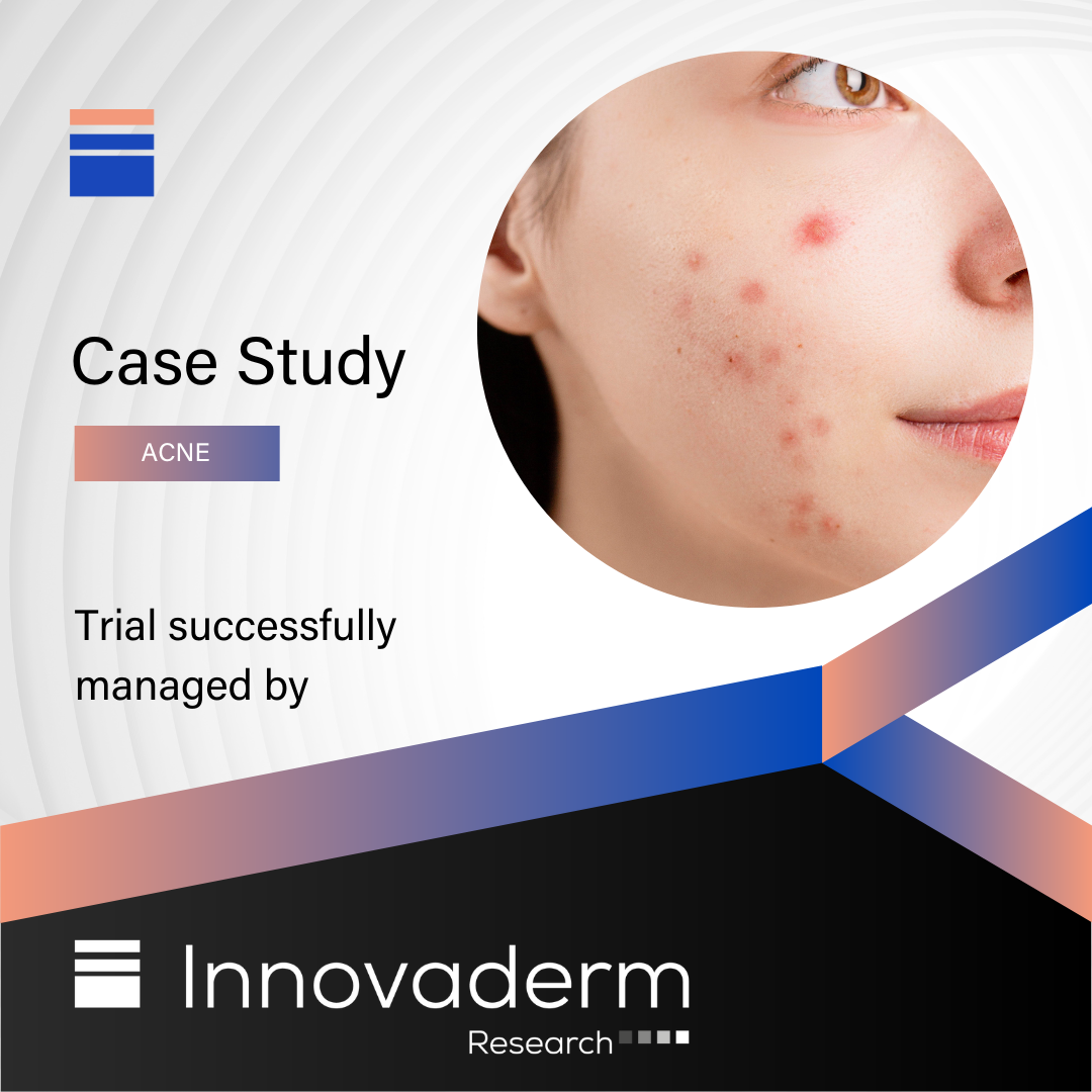 Acne case study