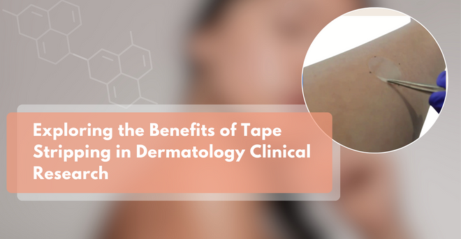 Tape Stripping Dermatology Clinical Research