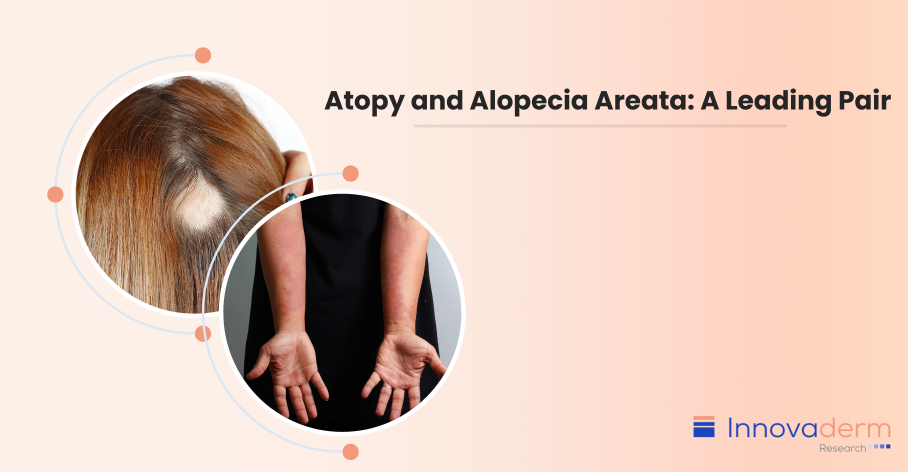 Atopy and Alopecia Areata