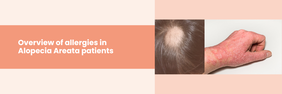 allergies in alopecia areata patients