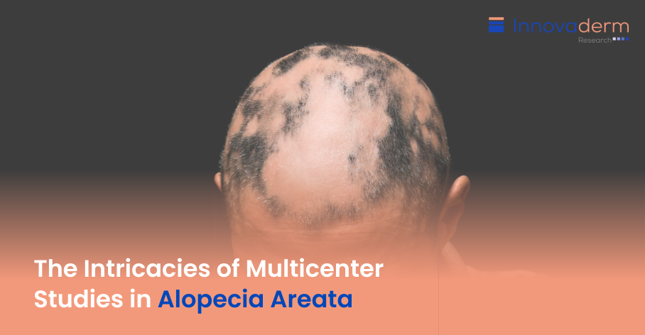 severity of alopecia tool salt