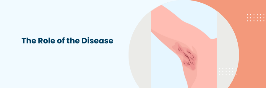 Role of Hidradenitis Suppurativa