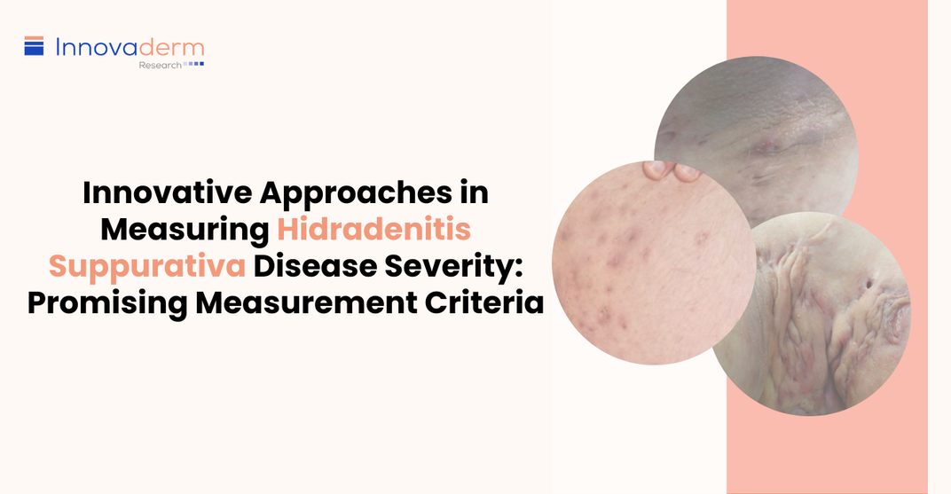 hidradenitis suppurativa severity index