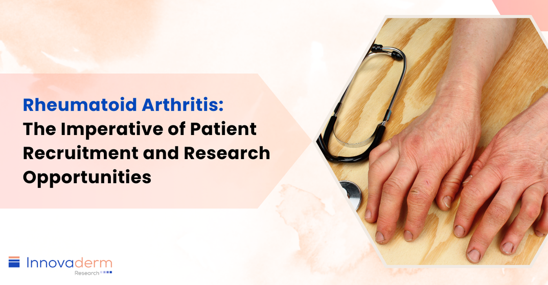 rheumatoid arthritis clinical trial